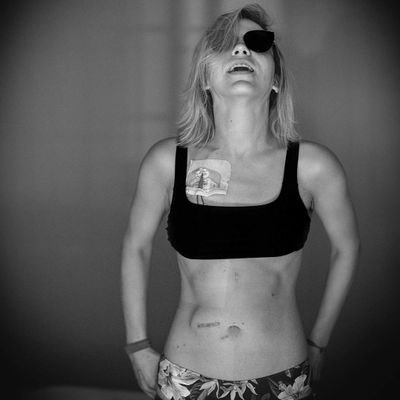 I fight every day against chronic diseases💪🏻🤮
I love animals🐕❣
🇺🇲❣️
#FuckDiabetes
#FuckGastroparesis