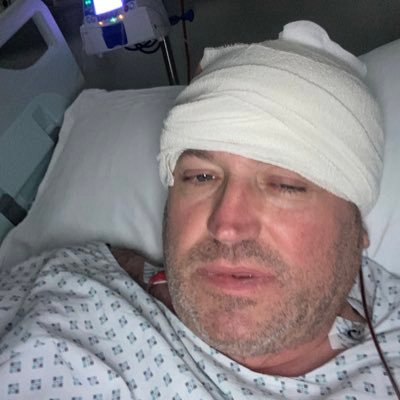 https://t.co/4LJXKMKTqi I have a grade 4 brain tumour, so trying so much to fight my way through it 💪 #Glioblastoma #GBM #Brain #Cancer