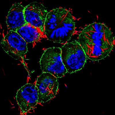 We are a group of microbiologists, bacterial and cancer geneticists, and computational scientists dedicated to deciphering the role of the microbiota in cancer.