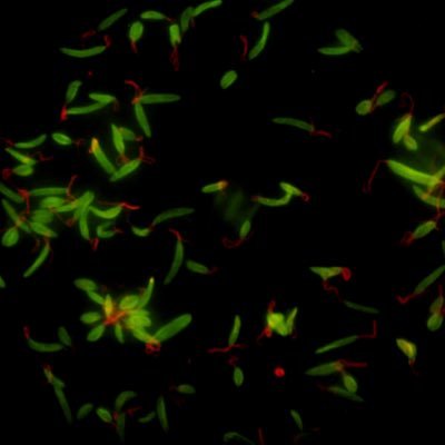 Protein scientist at Peak Proteins | PhD student in Biochemistry | Investigating galactokinase in L. donovani | Alhumdullilah