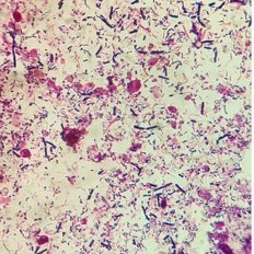 Servei de Microbiologia Clínica @hospitalclinic
Recerca @ISGLOBALorg @UniBarcelona
Docència @UniBarcelona