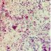 Microbiologia H.Clínic Barcelona (@microclinicbcn) Twitter profile photo Microbiologia H.Clínic Barcelona (@microclinicbcn) Twitter profile photo