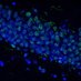 IUNICS-Research Institute of Health Sciences (@iunics_uib) Twitter profile photo IUNICS-Research Institute of Health Sciences (@iunics_uib) Twitter profile photo