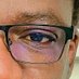 Abdoul Kader DEM, M.D, DES-BC ❤️ 🇧🇫✊🏾💪🏽✌🏾 (@abdoulkaderdem9) Twitter profile photo Abdoul Kader DEM, M.D, DES-BC ❤️ 🇧🇫✊🏾💪🏽✌🏾 (@abdoulkaderdem9) Twitter profile photo