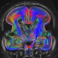 Pediatric Imaging Research Center (@pirc_mgh) 's Twitter Profile Photo Pediatric Imaging Research Center (@pirc_mgh) 's Twitter Profile Photo
