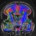 Pediatric Imaging Research Center (@pirc_mgh) Twitter profile photo Pediatric Imaging Research Center (@pirc_mgh) Twitter profile photo