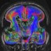 Pediatric Imaging Research Center (@PIRC_MGH) Twitter profile photo