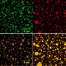 Membrane-Less Organelles Symposium (@mlossymposium) Twitter profile photo Membrane-Less Organelles Symposium (@mlossymposium) Twitter profile photo