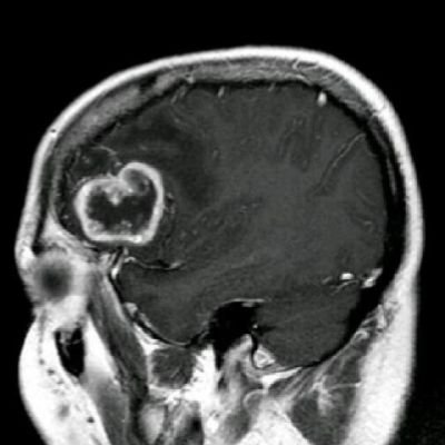 NeuroJJGP's profile picture. Canal creado con fines educativos