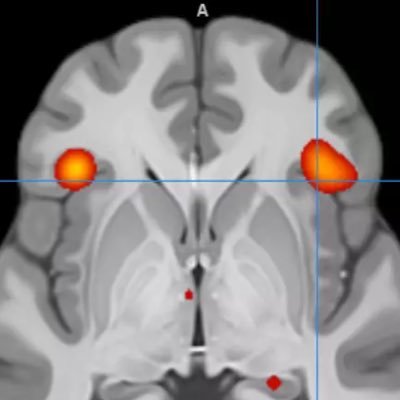 The latest research, news, and events from the Centre for Cognitive & Clinical Neuroscience (CCN) at Brunel University London.