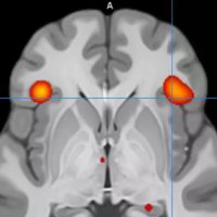 Centre for Cognitive & Clinical Neuroscience 🧠 (@brunelccn) Twitter profile photo