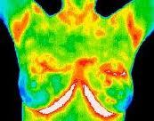 thermohealth's profile picture. Thermography is a screening tool using heat instead of radiation.  Detects inflammation and risk for breast cancer.  Also a Healthy Cooking Coach.