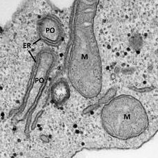 Our research focuses on the biogenesis and dynamics of cellular compartments, organelles (especially peroxisomes!) in health and disease @UniofExeter.