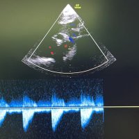 Neonatal POCUS Australia (@neopocusau) 's Twitter Profile