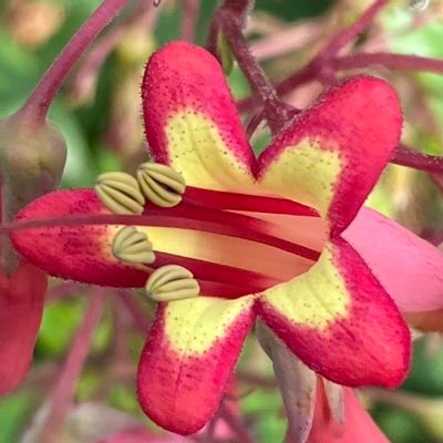 SheedyPaula's profile picture. I live with Young Onset Parkinson's, diagnosed in 1998 aged 30. Ileostomy since 1995 due to Crohn's disease. 2013 DBS surgery