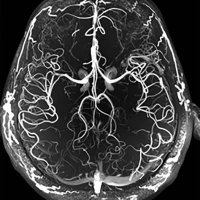 UCONN Stroke Fellowship Program (@hhneurovascular) 's Twitter Profile Photo UCONN Stroke Fellowship Program (@hhneurovascular) 's Twitter Profile Photo