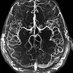 UCONN Stroke Fellowship Program (@hhneurovascular) Twitter profile photo UCONN Stroke Fellowship Program (@hhneurovascular) Twitter profile photo