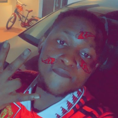 Manchester United die hard fan 🔥@manutd sure plug for all your medical and surgical equipment just dm me for more info