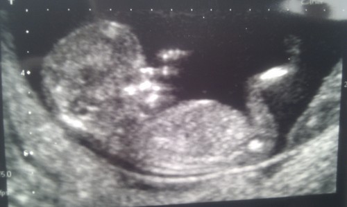 leelo102003's profile picture. 