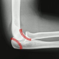 Pitching Doc (@mppitchingdoc) 's Twitter Profile