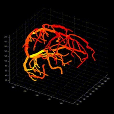 UC Davis Neurology Profile