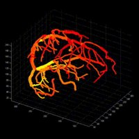 UC Davis Neurology(@UCD_Neurology) 's Twitter Profile Photo