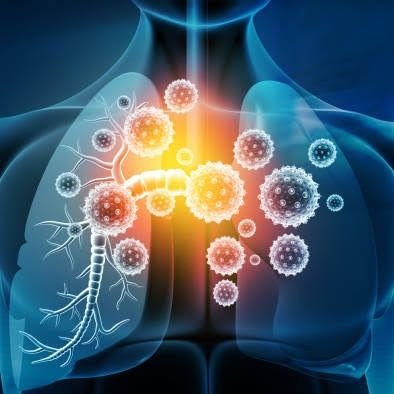 The Viral Immunity and Immunopathology Laboratory at 
@Hudson_Research
@CiiiD_Research

Host-directed therapies for #influenza and pulmonary inflammation