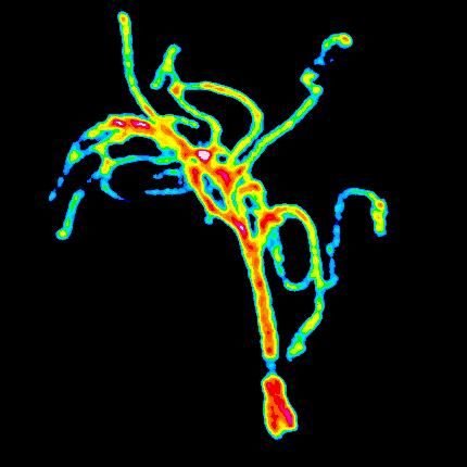 The Kaplan lab uses C. elegans as a model system to understand the molecular basis of rare diseases & functional inference of genetic variants.