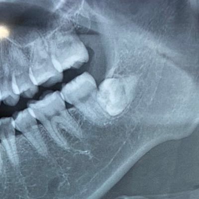 sono2nd's profile picture. アイコン本人です🦷