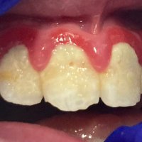 MouthCareMatters (@mcm_hekss) 's Twitter Profile Photo MouthCareMatters (@mcm_hekss) 's Twitter Profile Photo