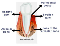 Periodontist serving to improve your gum and overall health