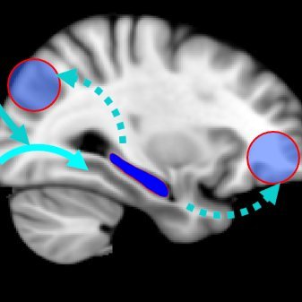 An NIH-funded longitudinal observational study of Multimodal Imaging of Cognition, Aging, and Alzheimer's Disease led by @OhLabBrown @BrownUniversity