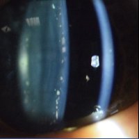 The REVEAL Study (@reveal_study) 's Twitter Profile Photo The REVEAL Study (@reveal_study) 's Twitter Profile Photo