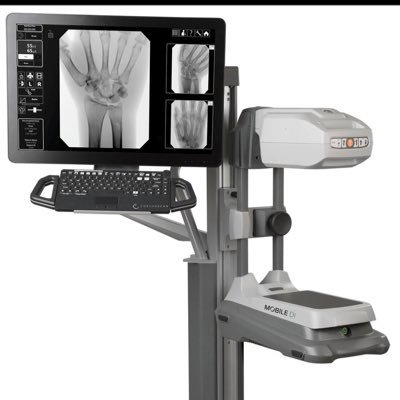 Mobile Digital X-Ray and Fluoroscopy Mini C-Arm designed for Orthopedics, Podiatrist, Plastic Hand Surgeons, Universities, Hospitals, and Labs.