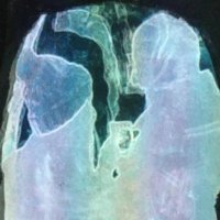 Aneirin Karadog 🏴🇺🇦 (@neikaradog) 's Twitter Profile Photo Aneirin Karadog 🏴🇺🇦 (@neikaradog) 's Twitter Profile Photo