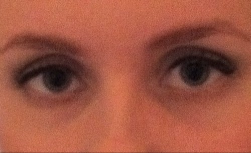 bipolar86's profile picture. Med student w bipolar type 1 rapid cycling.