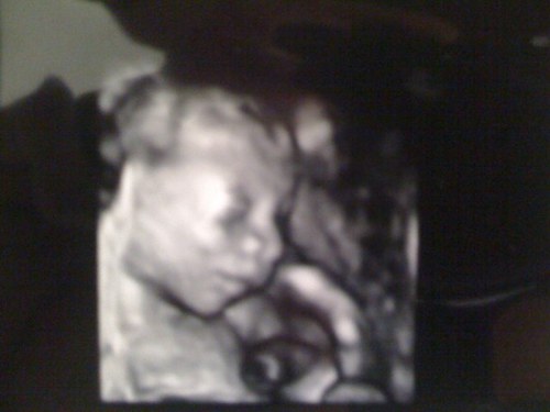 deargodimadad's profile picture. I'm a first time father, whose child is due on 11/28/11.  Here's how it's going......