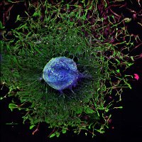 RADOPT_CRCT (@moyal_lab) 's Twitter Profile