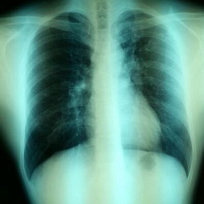 ゆうや 中学生の頃 部活の先輩が エロ 本のモザイク 黒く塗られた を消しゴムで消せば見えるって言われて 頑張った青春をふと思いだした 男性なら 通る道だと思うけどなぁ E 笑