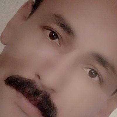 انا من مصر وعمري 50عام وعندي ثلاث اولاد الاول بكلرايوس حقوق والثانيه بنتي المربضه وعمرها22عام والثالثه اولي اعدادي وانا راجل ارزقي01014505955