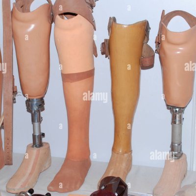 Kasi Amputee family Centre is a non profit organization created to help amputees with access to prosthetics and to rehabilitate them back into the community