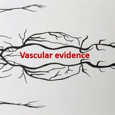 Evidence for healthcare in vascular conditions - follow for updates on future projects being developed (Cochrane Vascular is now closed)