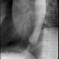 SARgerd_GiFluoroDFP (@sargifluoro_dfp) 's Twitter Profile Photo SARgerd_GiFluoroDFP (@sargifluoro_dfp) 's Twitter Profile Photo