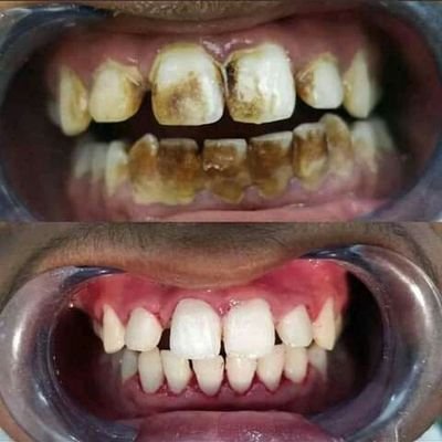 Creating smile,restoration and treatment of oral conditions with disorders,listening and consulting my client with a successful treatment plan.