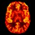 ISMRM Perfusion Study Group (@ismrm_perfusion) Twitter profile photo ISMRM Perfusion Study Group (@ismrm_perfusion) Twitter profile photo