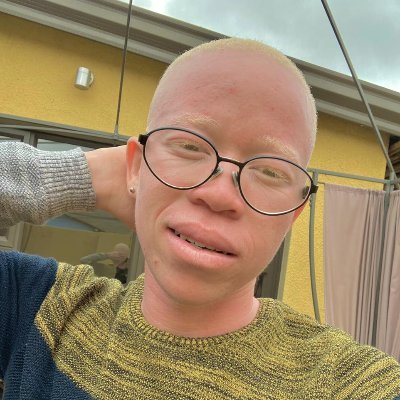 ℹ️ :The user is Living With Albinism 🤍🌚
Model 
Actor
Presenter  
Mr Khuma
Mr Kosh
I❤️🇿🇦
Let's Be Kind To Each Other Colour Means Nothing. 🫱🏻‍🫲🏿💐