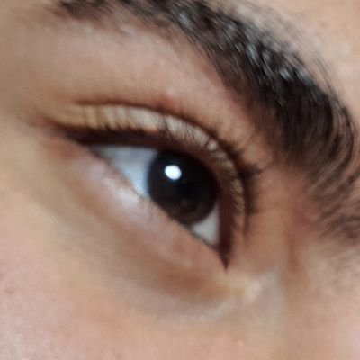 اگه میخوای تغییر کنی، بمیر، قبل از اینکه بمیری/اغلب مسائل به نفرون های کلیه ی چپمه🌹/انقلابیم🇮🇷