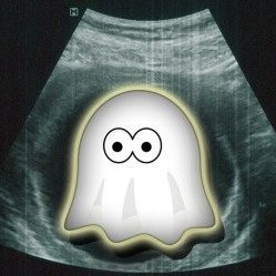 Join us as we visit only the most haunted uteri.
2%20
