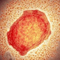 Infectious Disease Tracker(@HmpxvT) 's Twitter Profile Photo