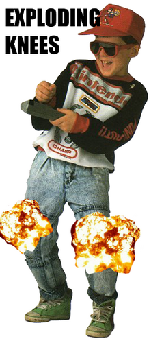 Exploding knees.
ლ(ಠ益ಠლ)
Y U NO FOLLOW?